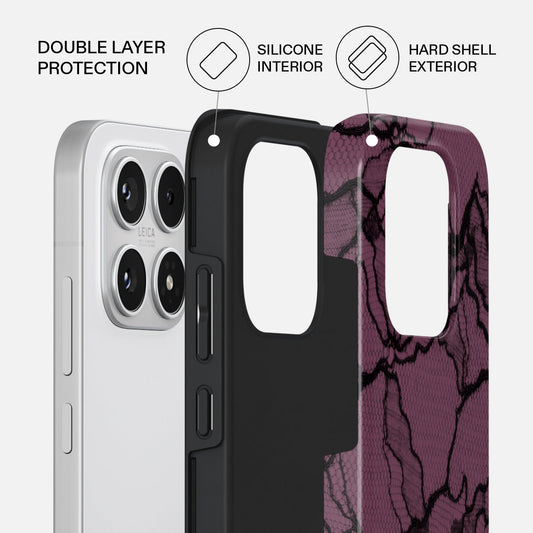 That Girl - Xiaomi 17 Case