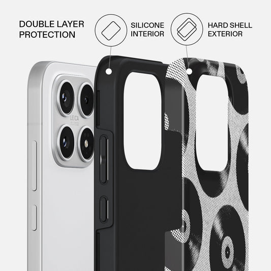 Sound Check - Xiaomi 17 Case
